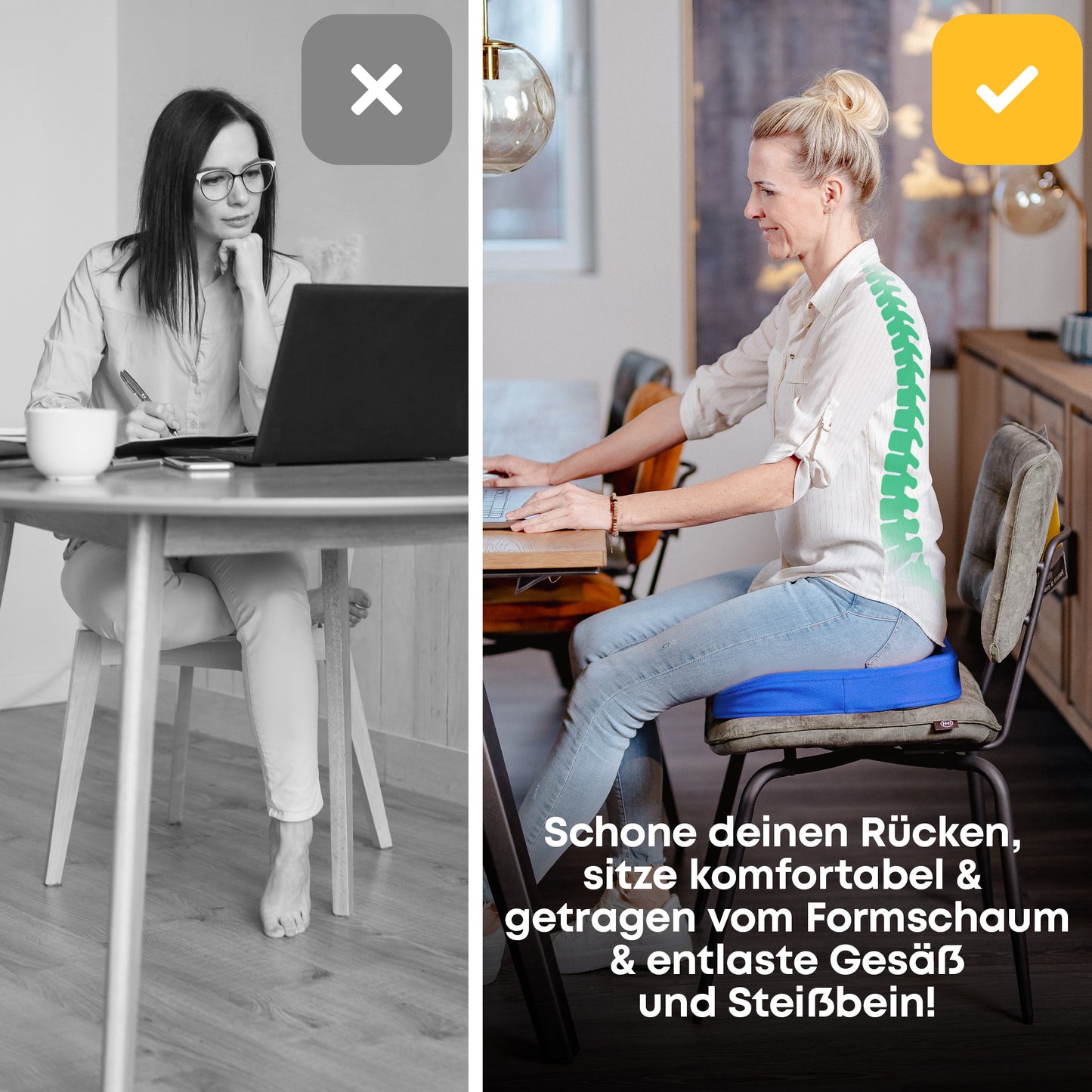 Orthopädisches PREMIUM Sitzkissen - PATENTIERT & FORMSTABIL | SANTERGO